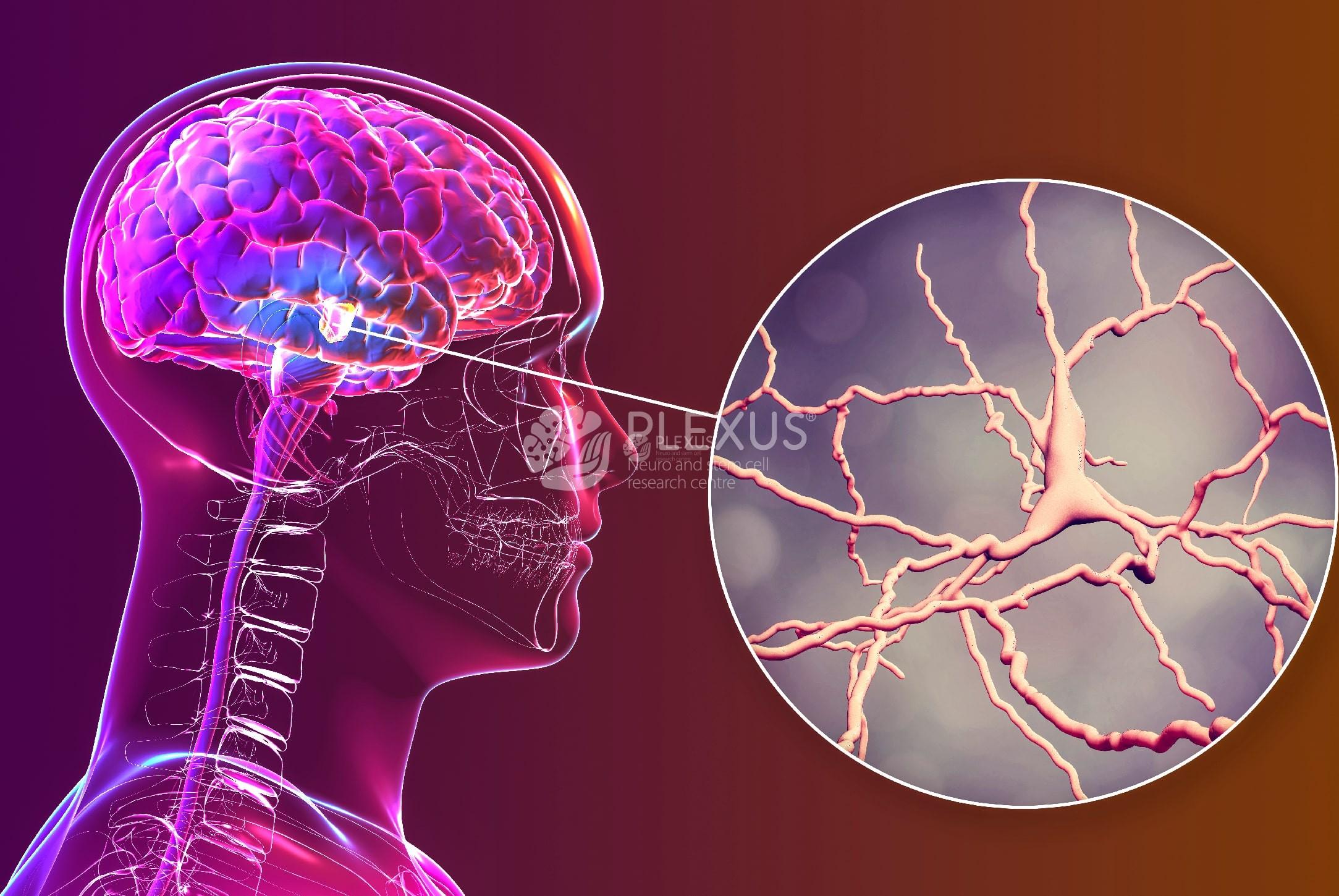 Causes of Spinocerebellar Ataxia min