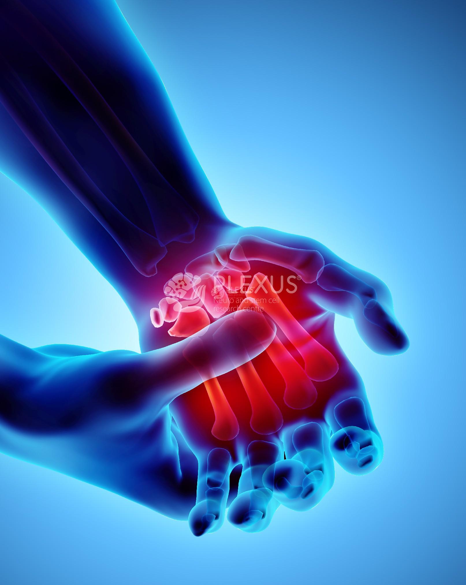 Rheumatoid arthritis diagonasis