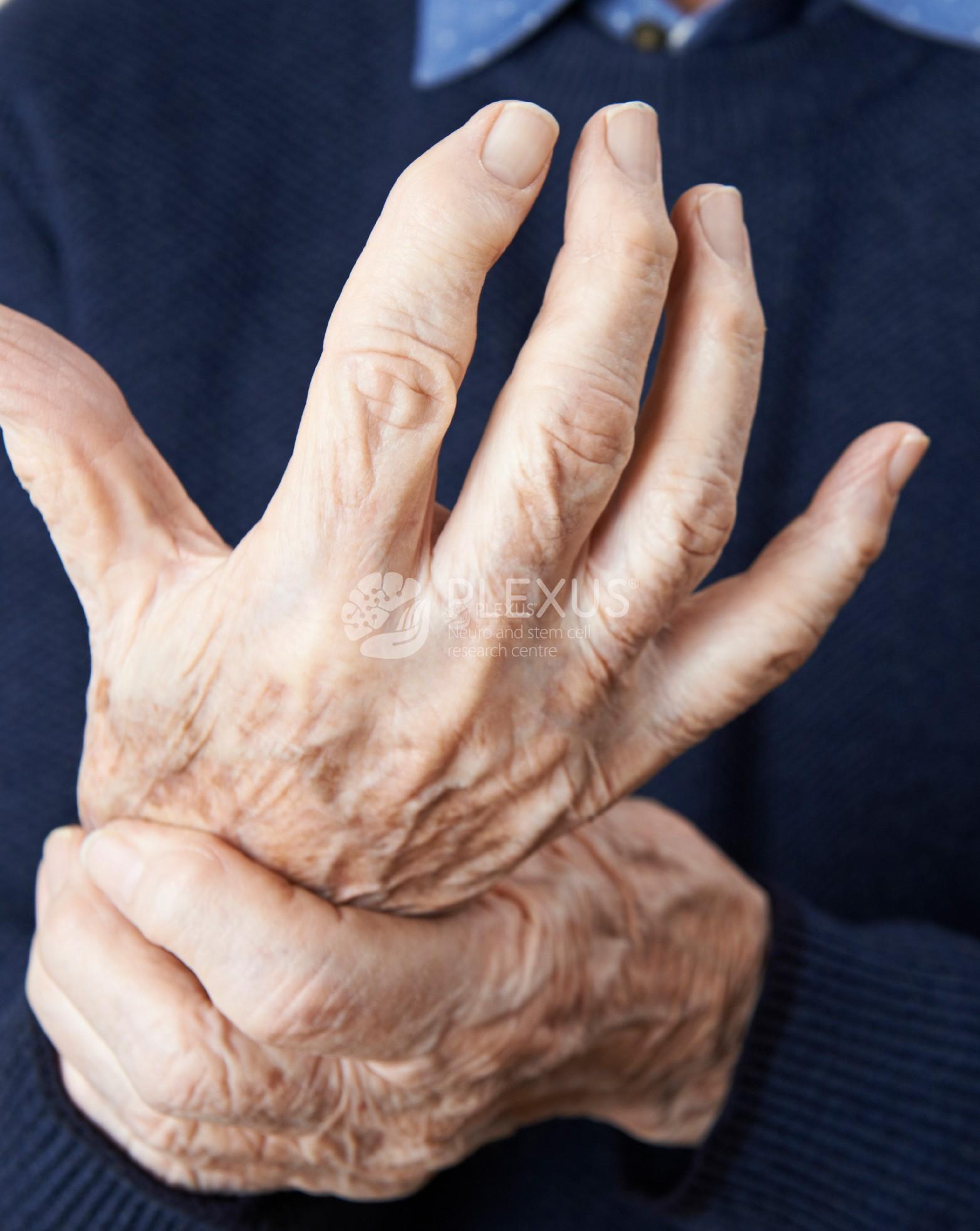 Rheumatoid arthritis treatment in Hyderabad