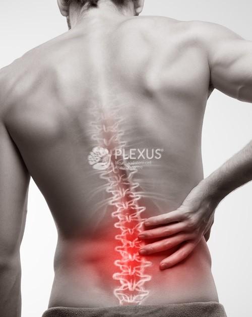 Transverse Myelitis causes