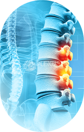 Transverse Myelitis