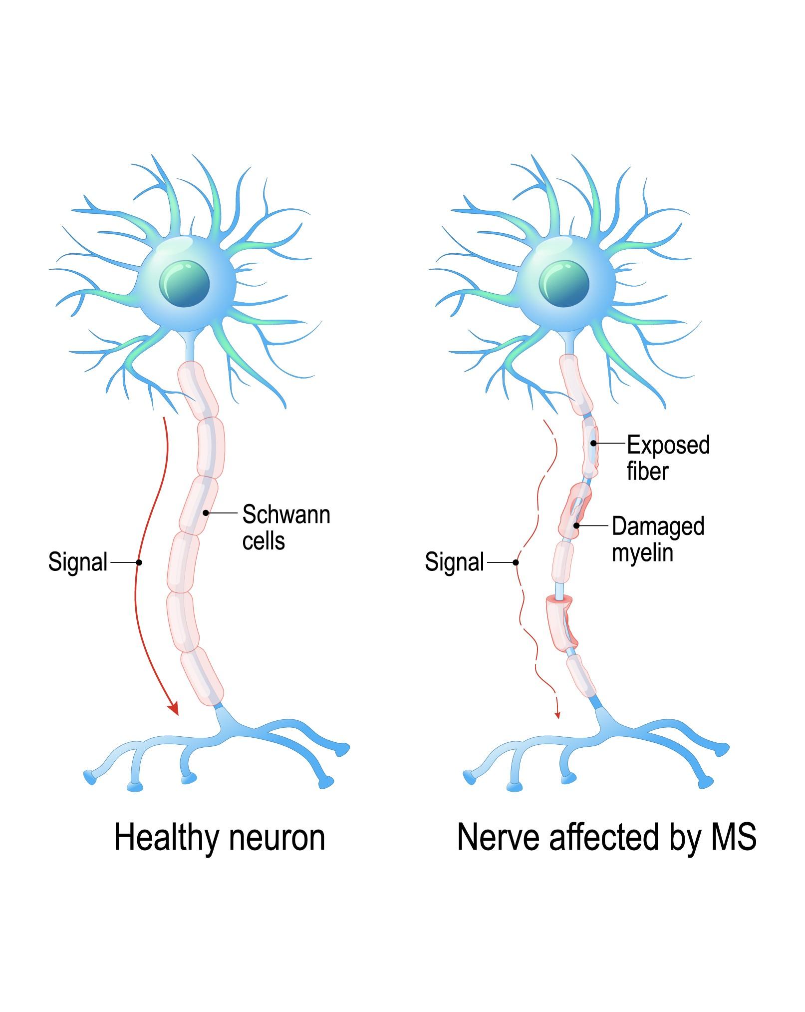 causes scelorisis