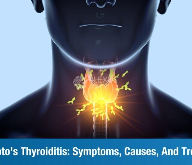 An Overview of Hashimoto’s Thyroiditis