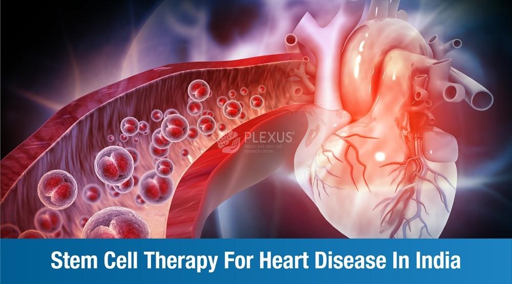 Stem Cell Therapy for Heart Disease