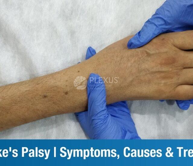 What is Klumpke’s Palsy? – Symptoms, Causes, Treatment