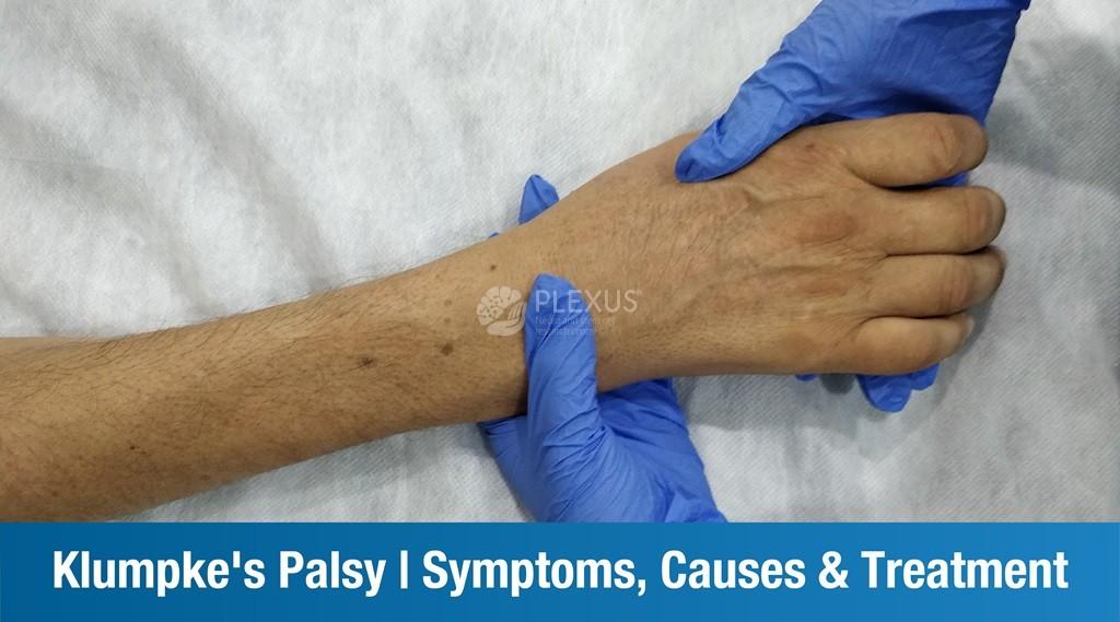 What is Klumpke’s Palsy? – Symptoms, Causes, Treatment