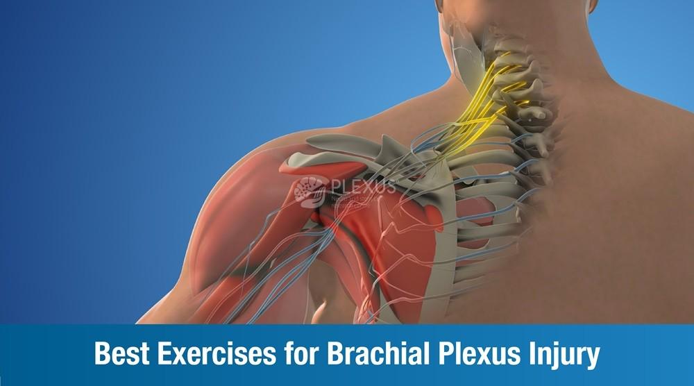 Best Exercises for Brachial Plexus Injury