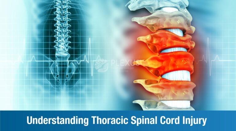 Understanding Thoracic Spinal Cord Injury 