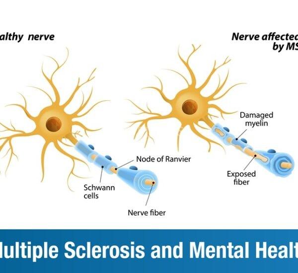 Multiple Sclerosis and Mental Health