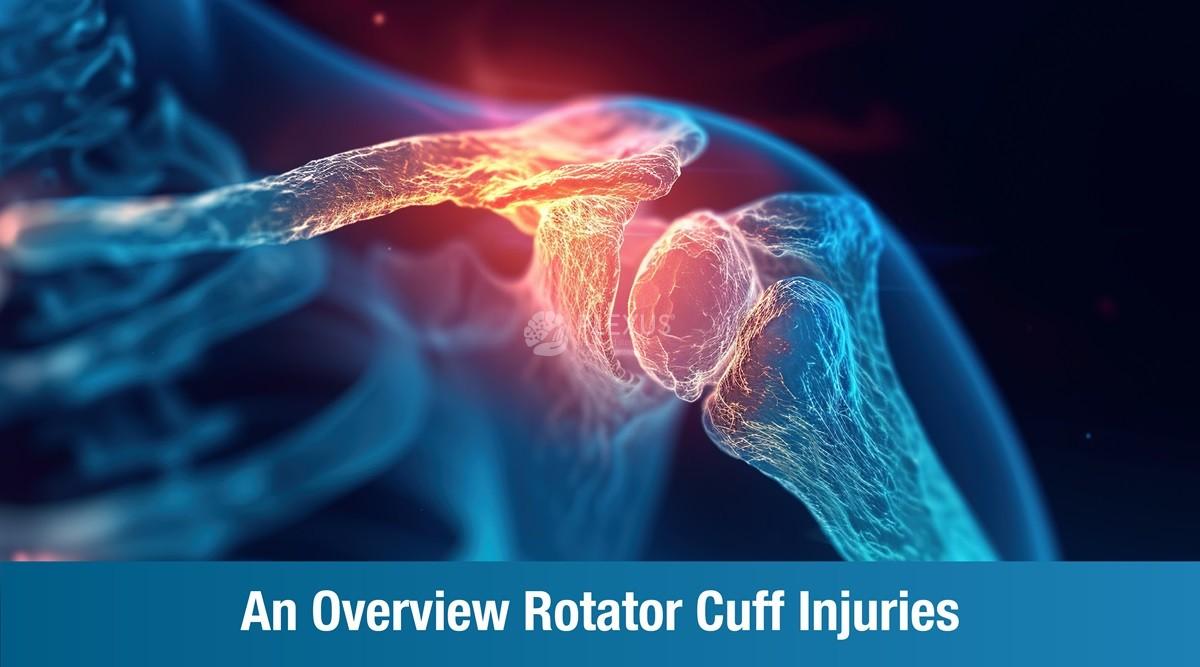 An Overview Rotator Cuff Injuries