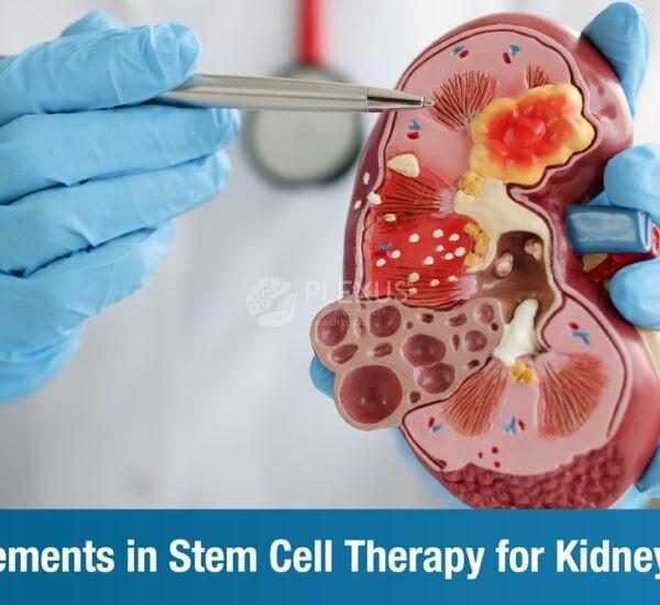 Advancements in Stem Cell Therapy for Kidney Failure