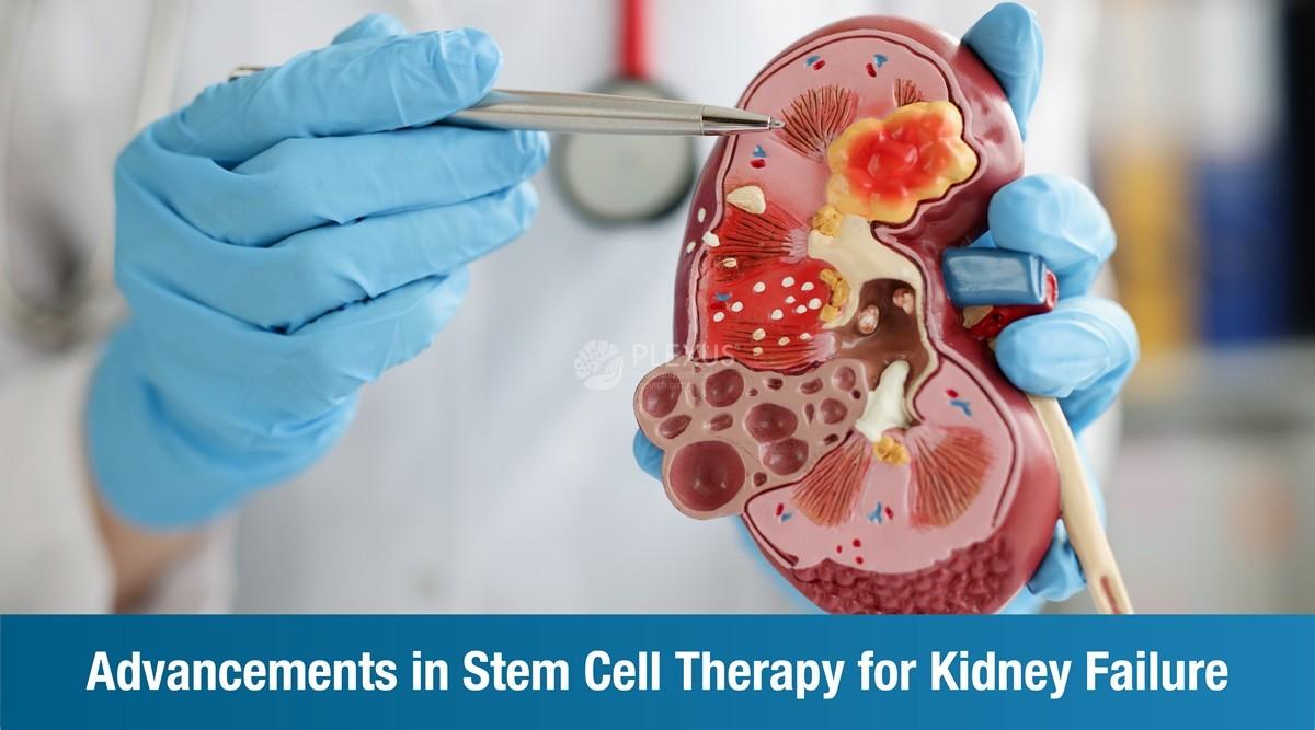 Advancements in Stem Cell Therapy for Kidney Failure