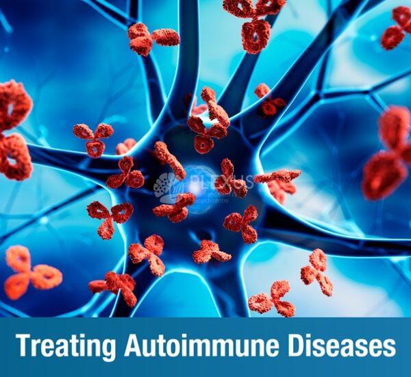 Treating Autoimmune Diseases