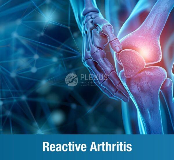 Reactive Arthritis : All You Need to Know