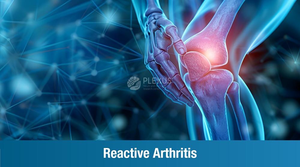 Reactive Arthritis : All You Need to Know