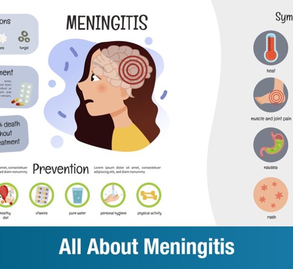 All About Meningitis: Symptoms, Causes, and Treatment