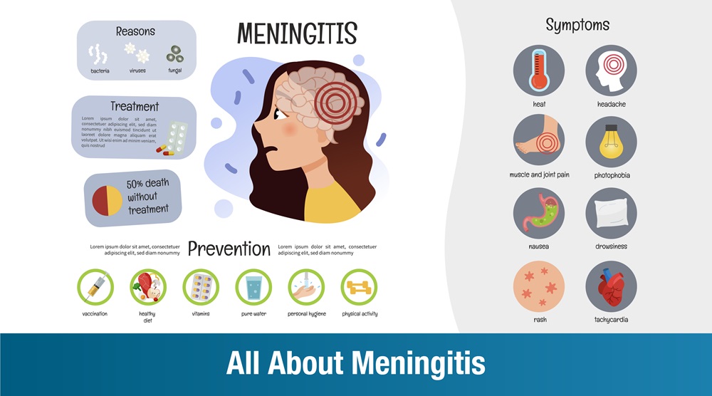 All About Meningitis: Symptoms, Causes, and Treatment