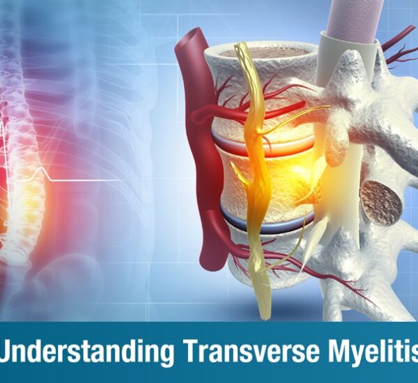 Understanding Transverse Myelitis: Causes, Symptoms, Treatment, and Recovery