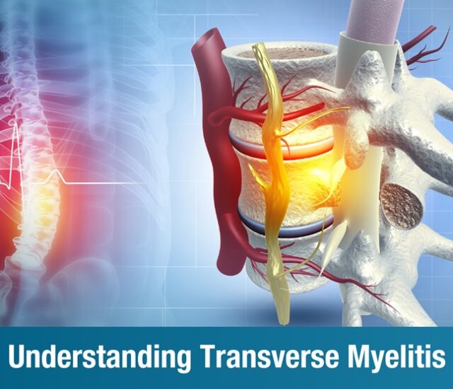 Understanding Transverse Myelitis: Causes, Symptoms, Treatment, and Recovery