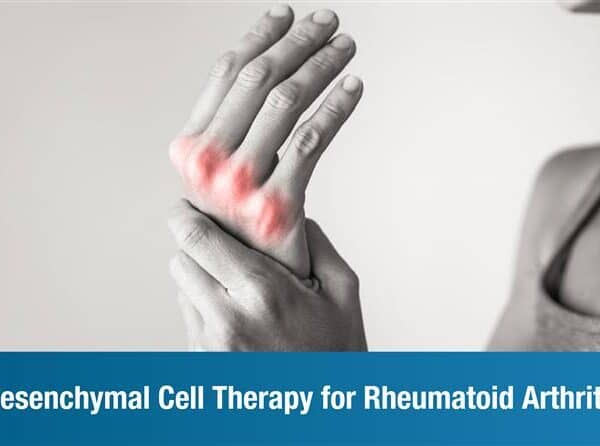 Autologous Mesenchymal Cell Therapy for Rheumatoid Arthritis