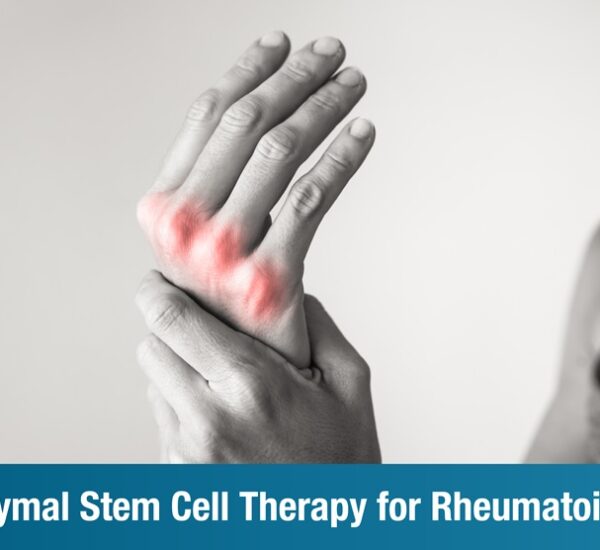 Mesenchymal Stem Cell Therapy for Rheumatoid Arthritis