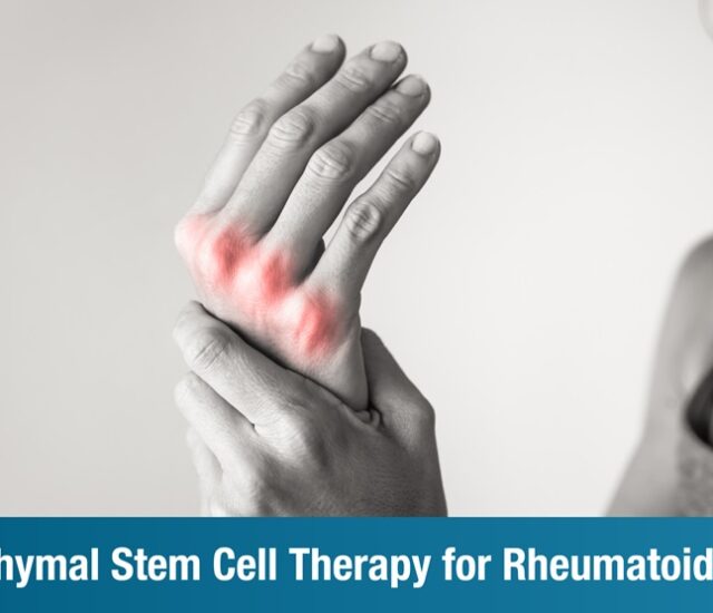 Mesenchymal Stem Cell Therapy for Rheumatoid Arthritis