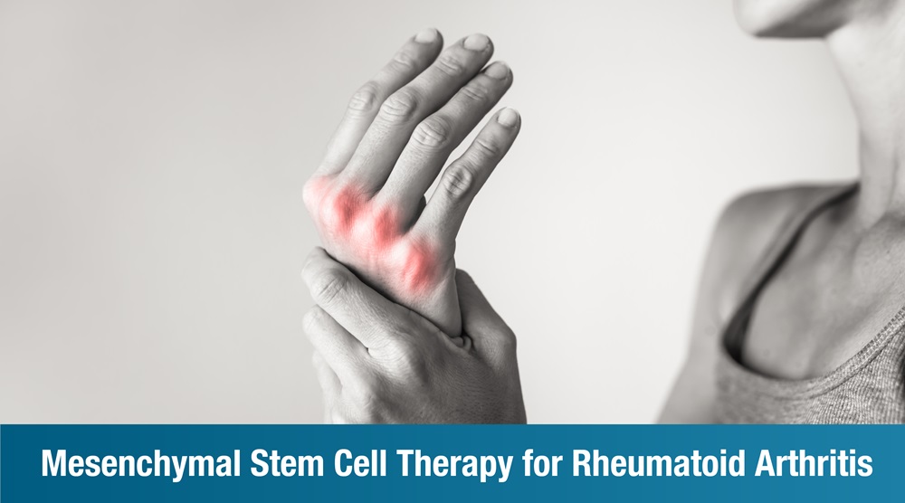 Mesenchymal Stem Cell Therapy for Rheumatoid Arthritis