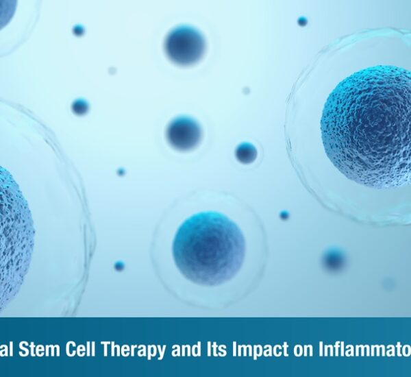 Mesenchymal Stem Cell Therapy and Its Impact on Inflammatory Disorders