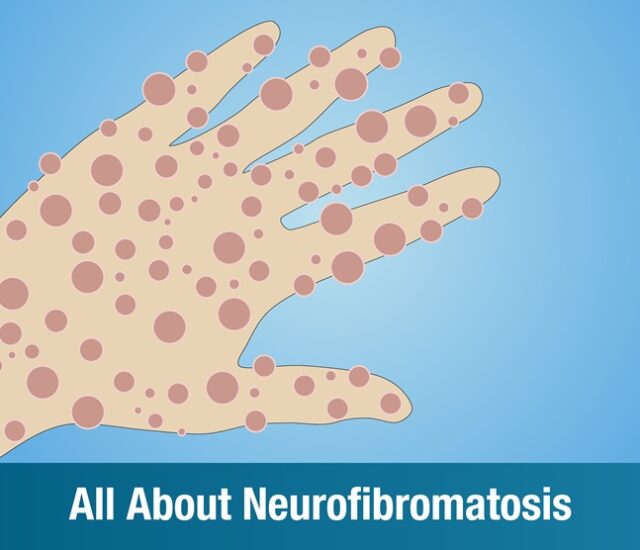 All About Neurofibromatosis