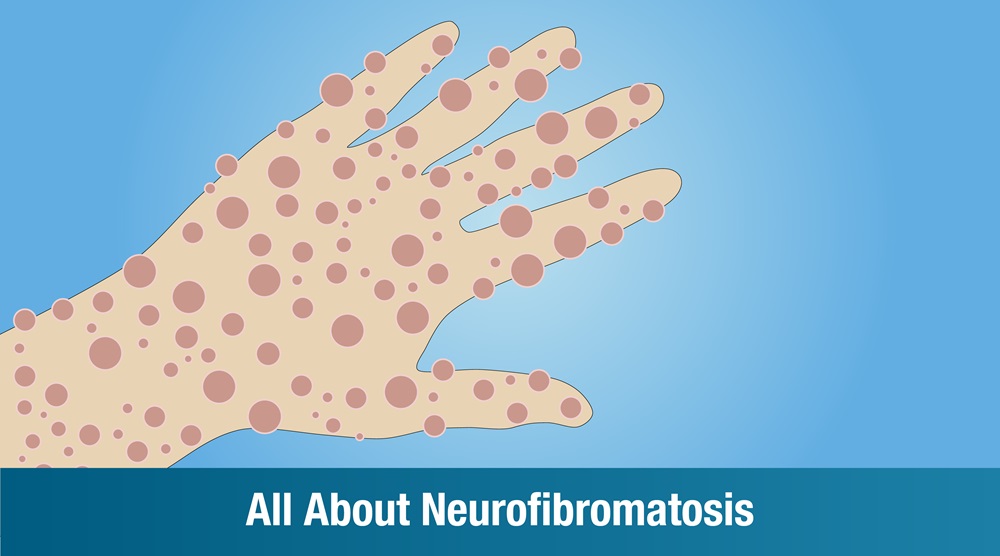 All About Neurofibromatosis