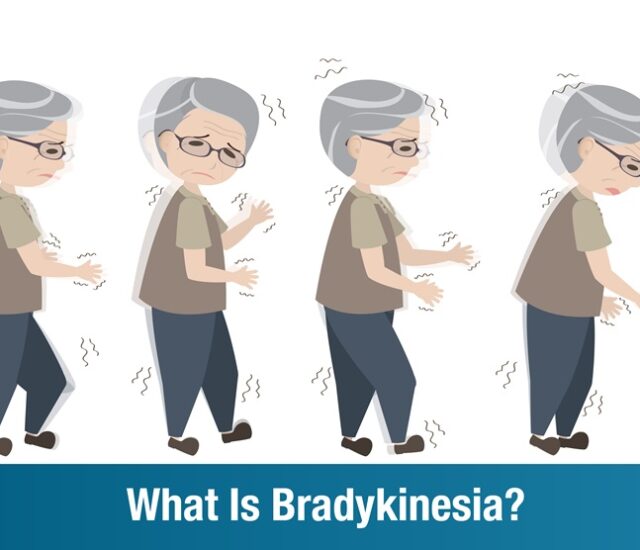 Bradykinesia: Causes, Symptoms, and Treatment