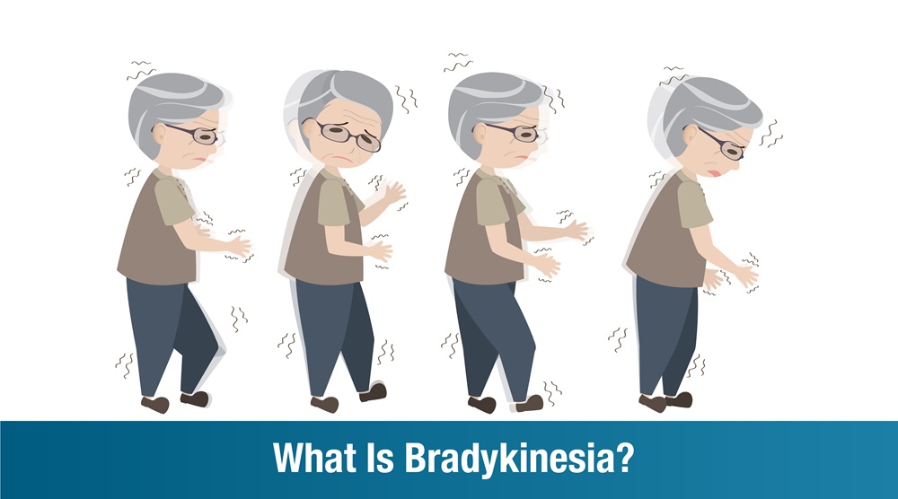 Bradykinesia: Causes, Symptoms, and Treatment