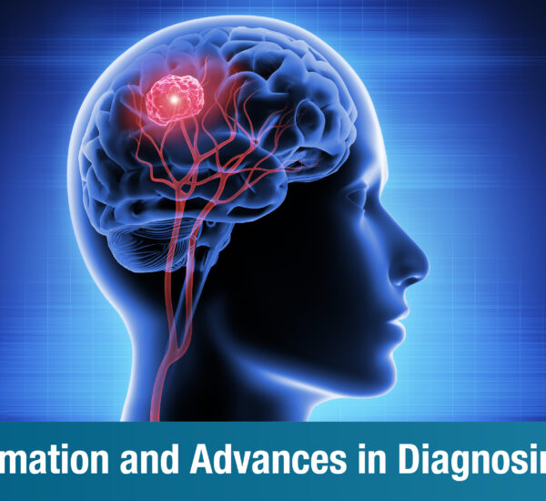 Understanding Progressive Supranuclear Palsy: Key Facts and Emerging Treatments