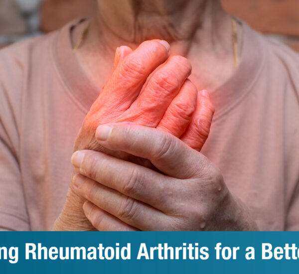 RA Treatment Guide: Effective Ways to Manage Rheumatoid Arthritis for a Better Quality of Life