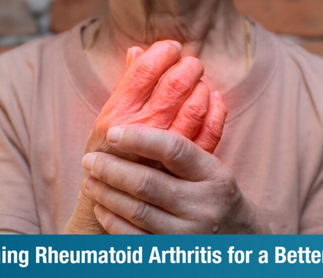 RA Treatment Guide: Effective Ways to Manage Rheumatoid Arthritis for a Better Quality of Life