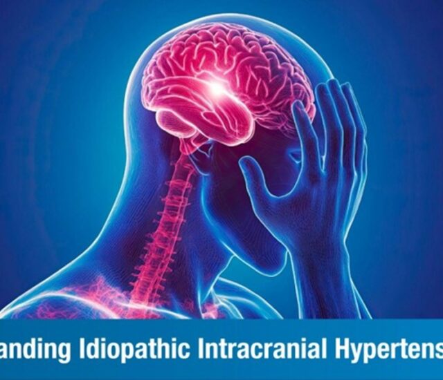Idiopathic Intracranial Hypertension (IIH): Causes, Symptoms, and Treatment Approaches