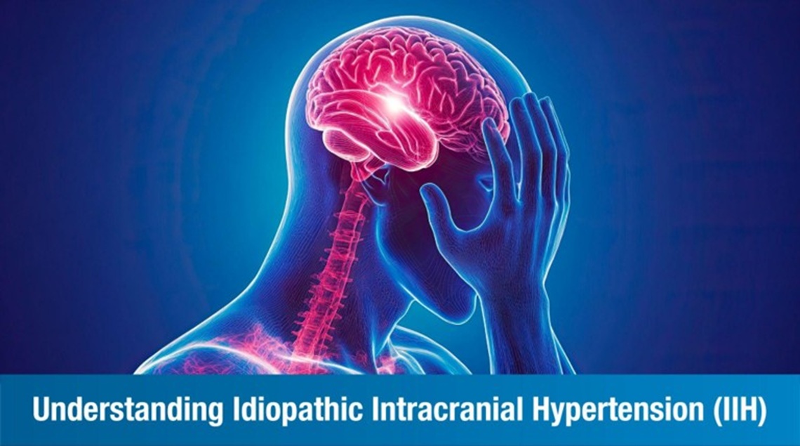 Idiopathic Intracranial Hypertension (IIH): Causes, Symptoms, and Treatment Approaches