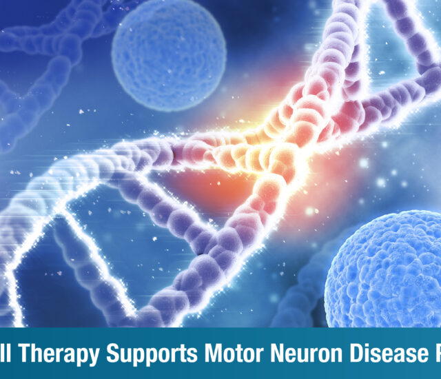 How Cell Therapy Supports Motor Neuron Disease Patients