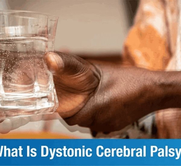 Dystonic Cerebral Palsy – An Overview