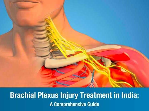 Brachial Plexus Injury Treatment in India: A Comprehensive Guide