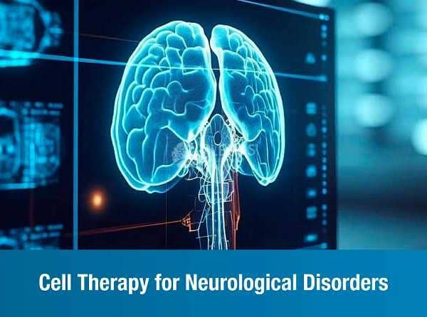 Cell Therapy for Neurological Disorders