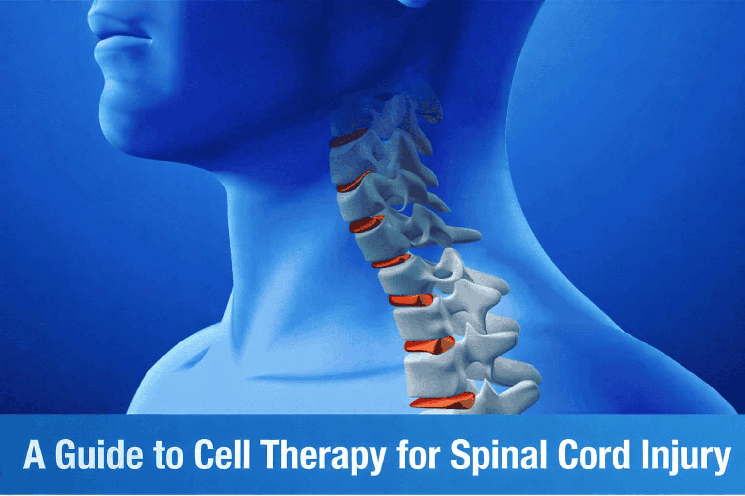 Cell Therapy for Spinal Cord Injury: A Complete Guide to Regenerative Recovery