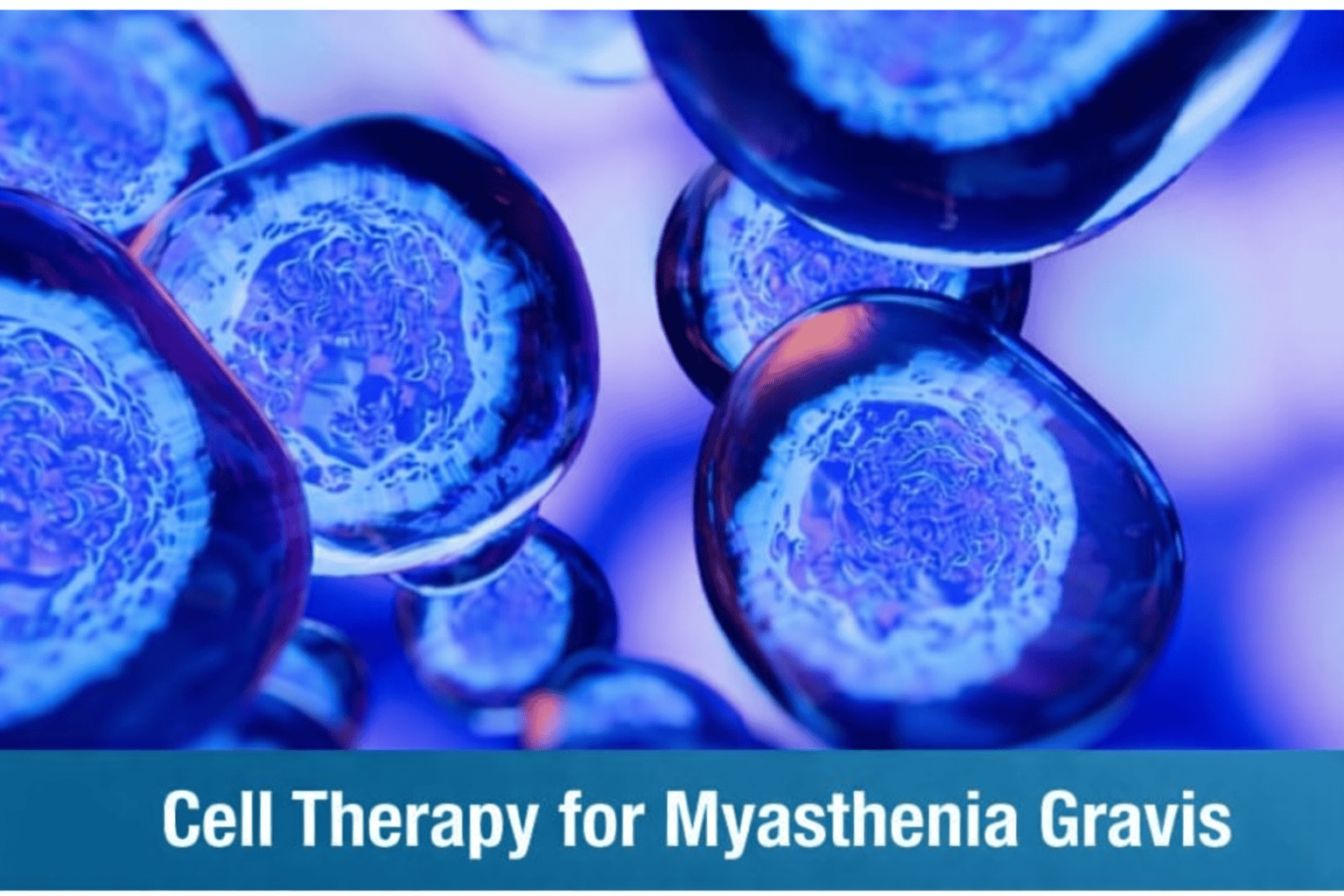 Cell Therapy for Myasthenia Gravis: A Regenerative Breakthrough for Long-Term Neuromuscular Stability