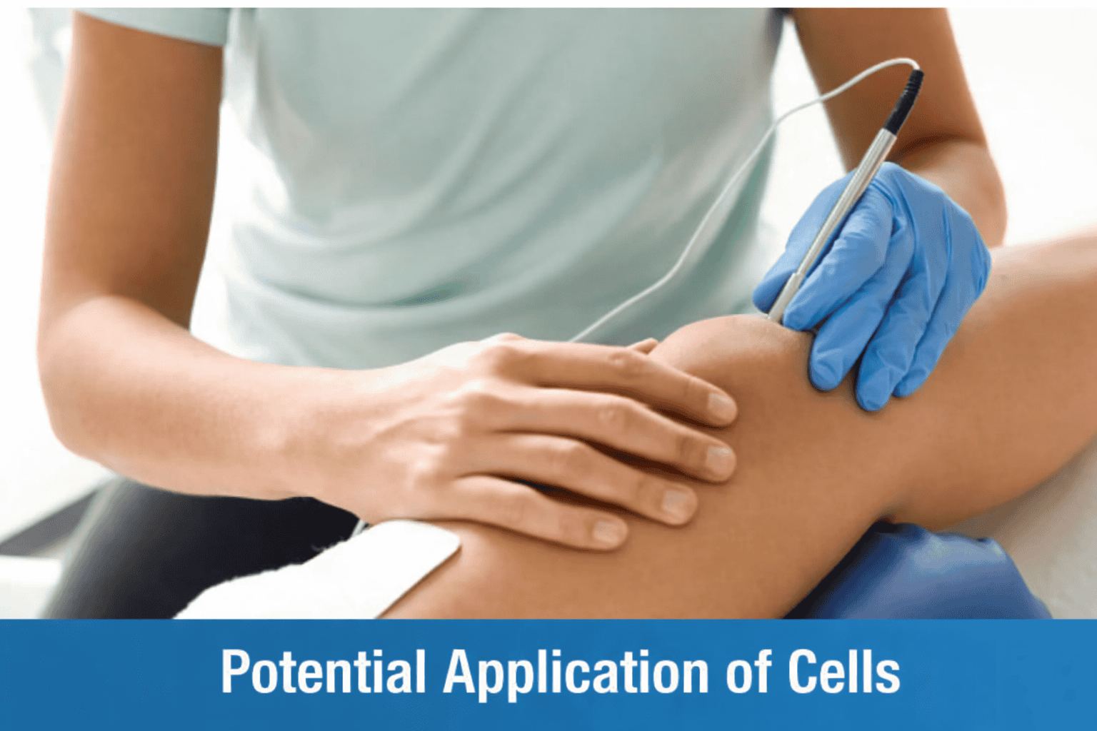 Potential applications of Autologous Bone Marrow Derived Cells