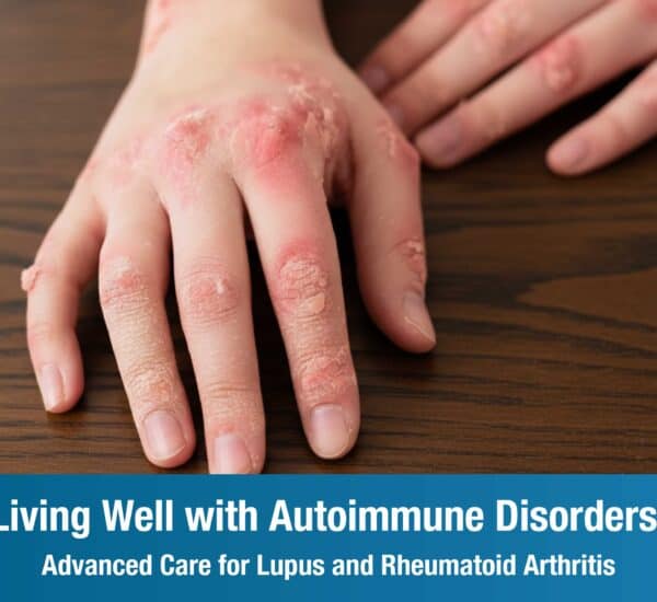 Living Well with Autoimmune Disorders:  Advanced Care for Lupus and Rheumatoid Arthritis