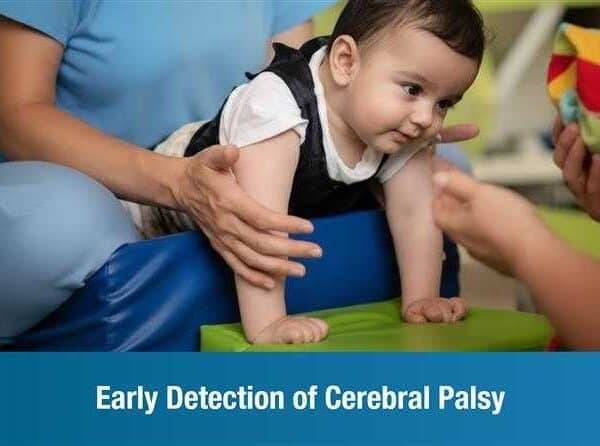 Early Detection of Cerebral Palsy
