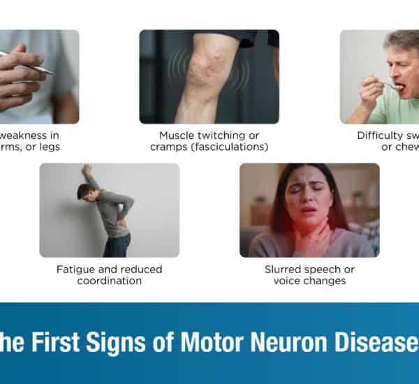 What Are the First Signs of Motor Neuron Disease in Adults?