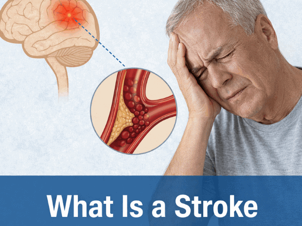 What Is a Stroke? Meaning, Types, Symptoms & Treatment