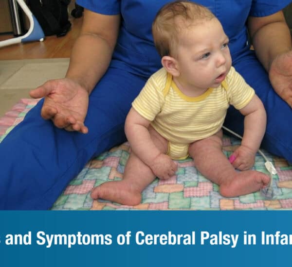 Early Signs and Symptoms of Cerebral Palsy in Infants | Plexus