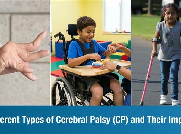Different Types of Cerebral Palsy (CP) and Their Impact